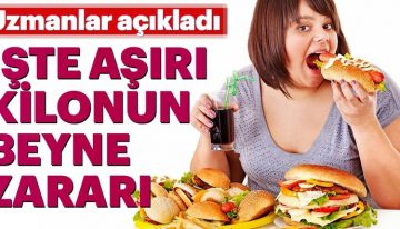 Aşırı kilo beyni küçültüyor