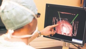 Parkinson erken teşhis edilebilir