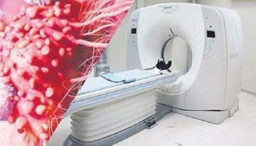 Röntgen ile kanser arasında bağ var