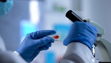 HIV kontrol altında tutulabiliyor